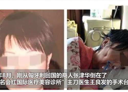 斯乐克u盘厂家分享商人抽脂失败 昏迷10年死亡